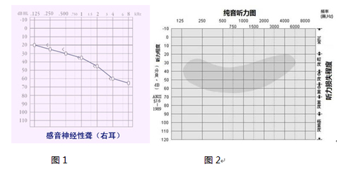 人耳能听多少音分